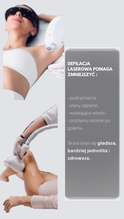 Depilacja laserowa: zdjęcie 98697734