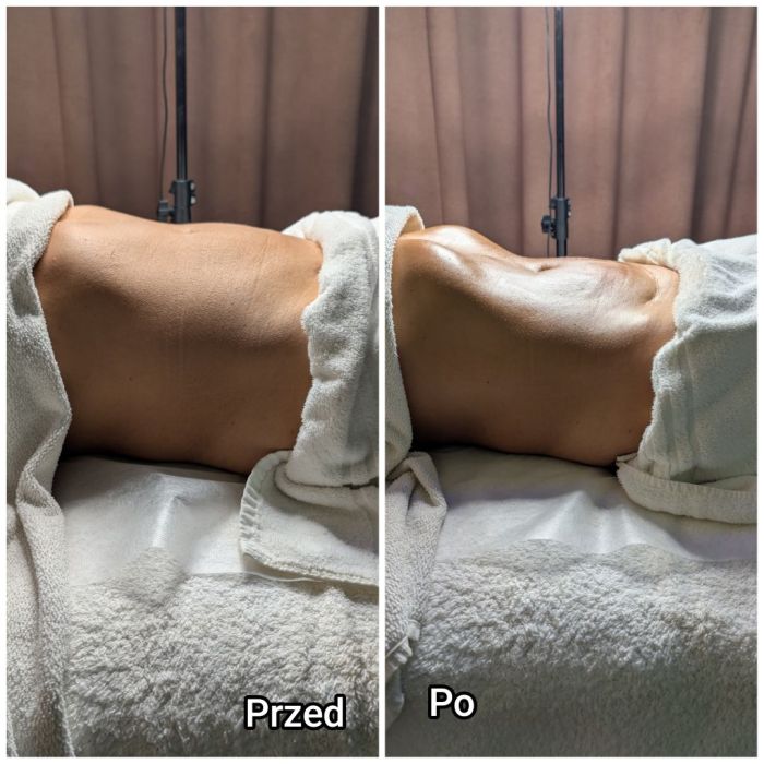 masaż, modelowanie sylwetki, Kobido: zdjecie 99463040