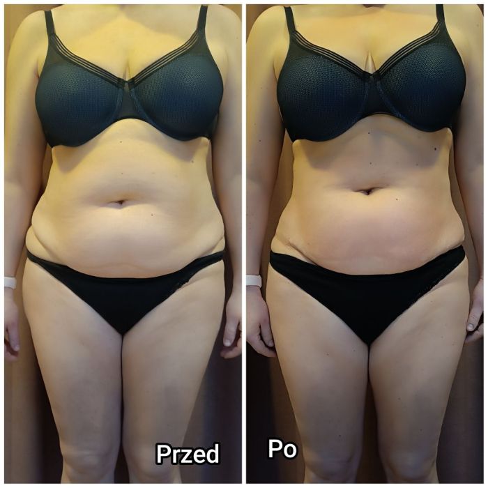 masaż, modelowanie sylwetki, Kobido: zdjecie 99466405