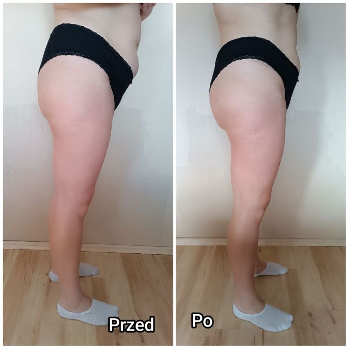 masaż, modelowanie sylwetki, Kobido: zdjecie 99466406