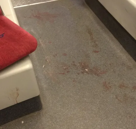 Krew na podłodze w tramwaju. Tak jeździ się po Gdańsku...