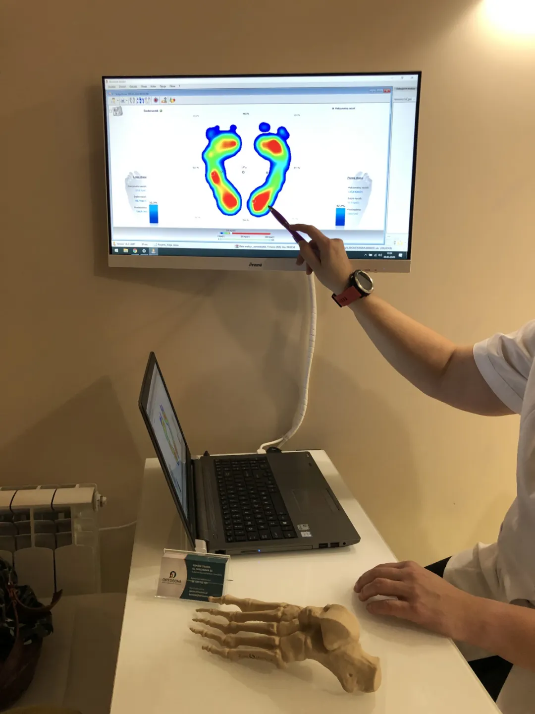 Biomechanika w gabinetach ORTOSOVA - Klinika Biomechaniki i Podologii