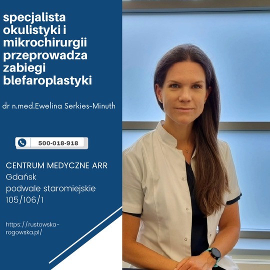 Dr N Med Ewelina Serkies Minuth Okulista Mikrochirurg Okuloplastyk Gdańsk 0071