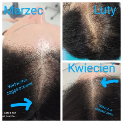 Experci w trychologii