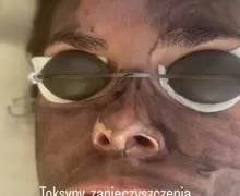 Chcesz HOLLYWOOD GLOW? 