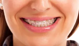 Ortodoncja dla dorosłych