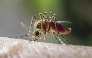 Jak odstraszyć komary i zmniejszyć ból po ukąszeniu?
