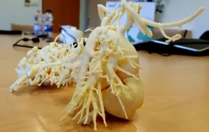 Serca z drukarki 3D ratują życie dzieci. Będą kolejne modele