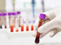 Rusza tydzień bezpłatnych testów w kierunku HIV