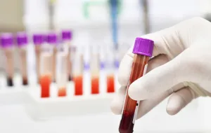 Rusza tydzień bezpłatnych testów w kierunku HIV