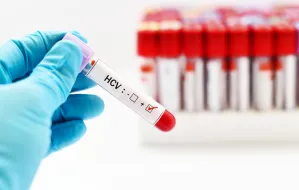 Bezpłatne testy anty-HCV na Pomorzu