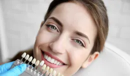 Wybielanie zębów - o czym warto wiedzieć?