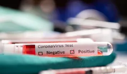Testy na koronawirusa dla wszystkich pacjentów i personelu medycznego
