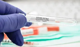 Rozpoczyna się produkcja pierwszego polskiego testu na koronawirusa