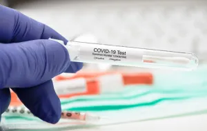 Rozpoczyna się produkcja pierwszego polskiego testu na koronawirusa