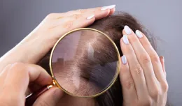 Jak poradzić sobie ze zniszczonymi włosami?