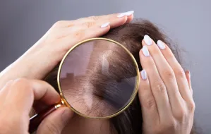 Jak poradzić sobie ze zniszczonymi włosami?
