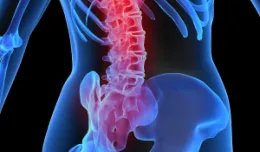 Osteoporoza może zaatakować w każdym wieku