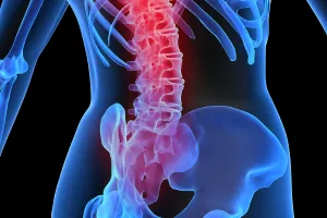 Osteoporoza może zaatakować w każdym wieku