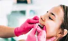 Aparat ortodontyczny dla dziecka - kiedy zacząć nosić i jak się do tego przygotować?