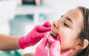 Aparat ortodontyczny dla dziecka - kiedy zacząć nosić i jak się do tego przygotować?