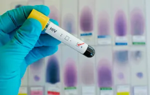 Na Pomorzu liczba zgłoszeń na badania pod kątem HIV spadła o 40 proc.