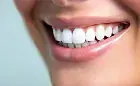 Wybielanie zębów. Jakie metody są najbardziej skuteczne?