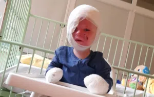 3-letni Franek został dotkliwe poparzony. Zoperował go światowej sławy lekarz z Bostonu