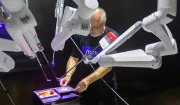 Operacja robotem Da Vinci w Centrum św. Jana za pomocą...pędzli