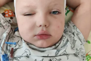 U Nikosia zdiagnozowano guza mózgu. Dziecko walczy o wzrok