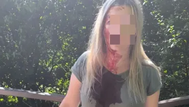 Dwukrotnie uderzył kobietę drewnianą laską w głowę. Zatrzymali sprawcę