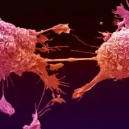 Profilaktyka raka piersi - wykład