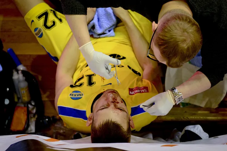 Szybkie zszycie złamanego nosa nie uchroniła Jarosława Mokrosa przed wizytą w szpitalu