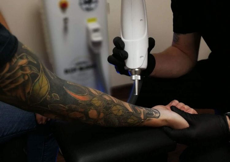 Usuwanie tatuaży jest możliwe dzięki laserom. Wiele studiów tatuażu, a nawet salonów kosmetycznych oferuje usuwanie takich "błędów młodości".