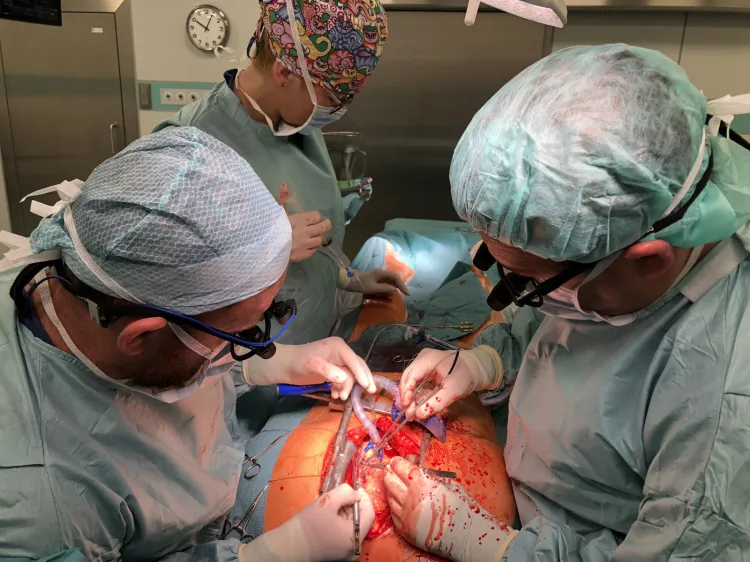 Kardiochirurdzy dr Krzysztof Roszak i Sebastian Batkiewicz (asysta) oraz pielęgniarka operacyjna Marzena Pudysiak podczas operacji pomostowania tętnic wieńcowych (wszczepienia tzw. bypassów). 