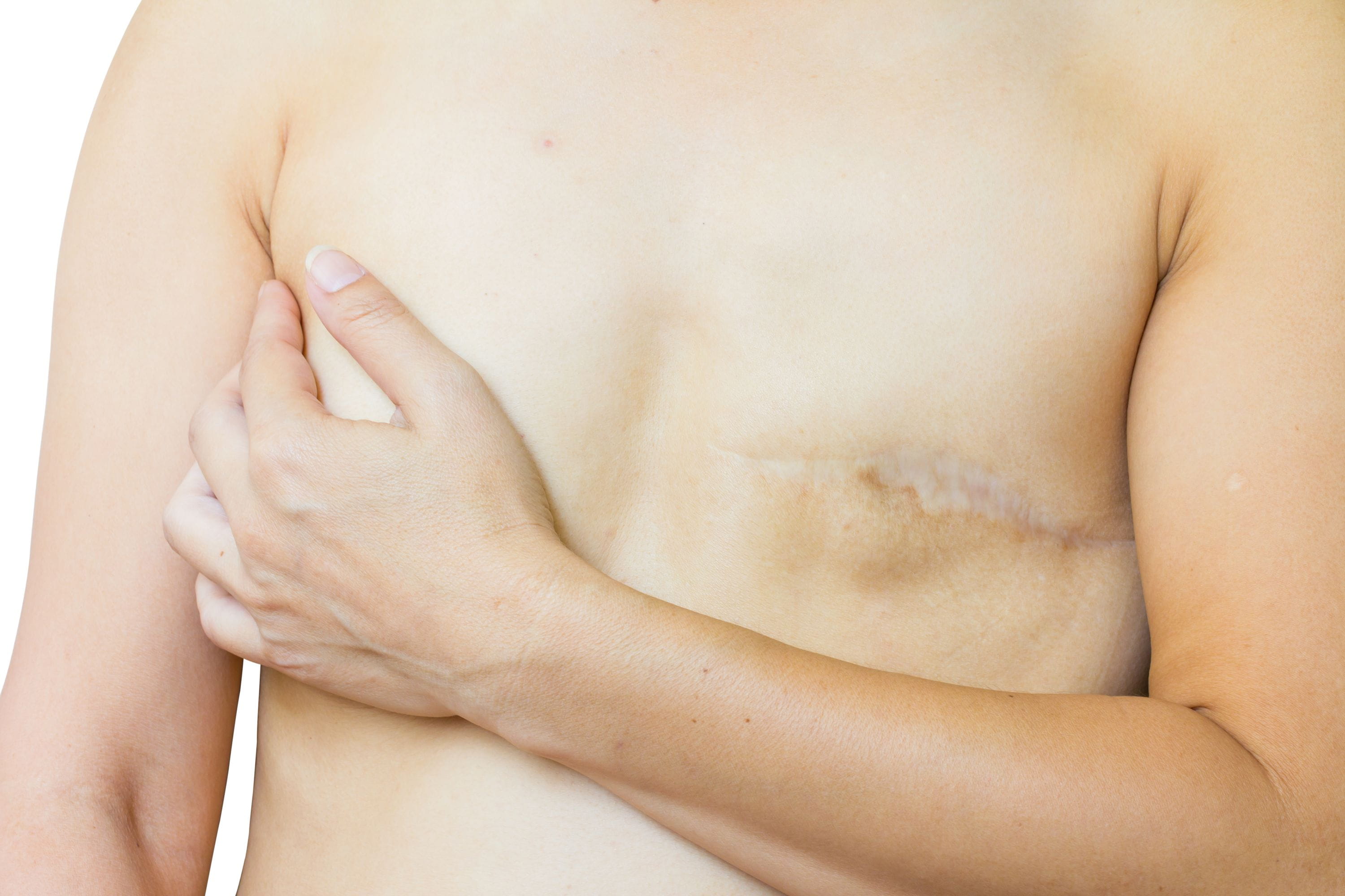 ушиб груди у женщин чем лечить в домашних условиях фото 106
