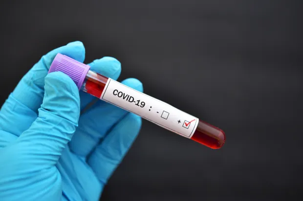 W całej Polsce prowadzone są badania dotyczące wykrycia zarażeń  nowym koronawirusem SARS-CoV-2. O tym, jak sytuacja wygląda na Pomorzu, Wojewódzka Stacja Sanitarno-Epidemiologiczna będzie informowała codziennie po godz. 14.  