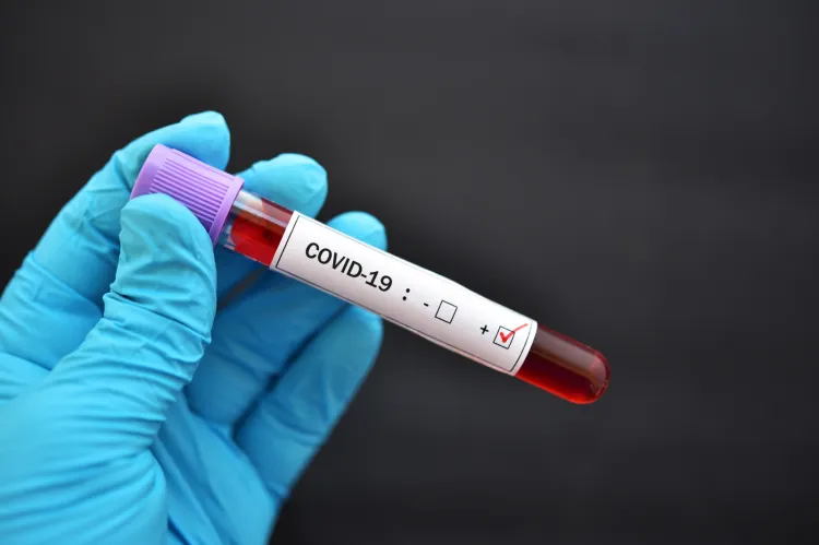 W całej Polsce prowadzone są badania dotyczące wykrycia zarażeń  nowym koronawirusem SARS-CoV-2. O tym, jak sytuacja wygląda na Pomorzu, Wojewódzka Stacja Sanitarno-Epidemiologiczna będzie informowała codziennie po godz. 14.  