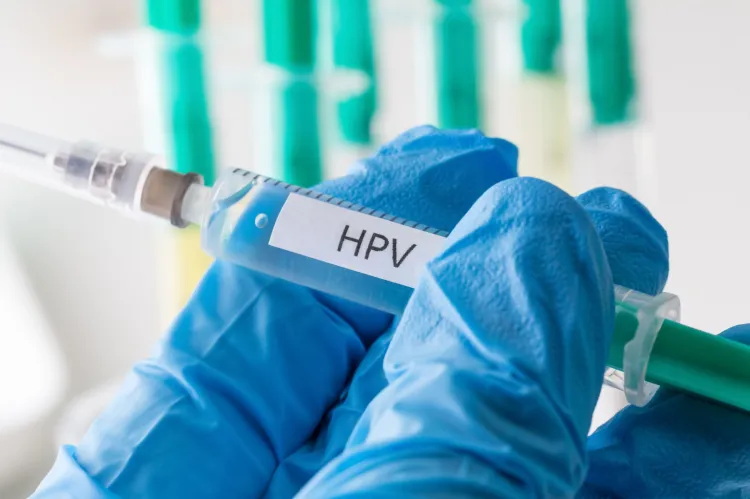 HPV to jeden z najczęściej przenoszonych drogą płciową wirusów. Jest trudny do leczenia, bo w ogromnej większości przypadków zakażenie ma charakter bezobjawowy.