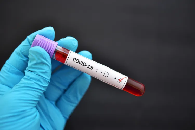 W całej Polsce prowadzone są badania dotyczące wykrycia zarażeń nowym koronawirusem SARS-CoV-2. O tym, jak sytuacja wygląda na Pomorzu, Wojewódzka Stacja Sanitarno-Epidemiologiczna informuje codziennie po godz. 18.