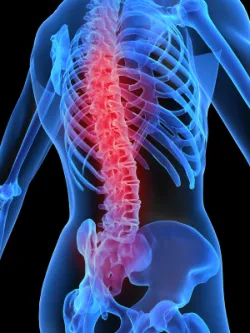 Osteoporoza może dopaść cały kościec chorego.