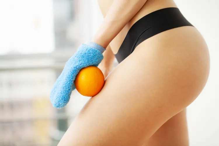 Problem cellulitu dotyka ponad 90 proc. kobiet na całym świecie. "Pomarańczowa skórka" to wynik złej diety, zaburzonej gospodarki hormonalnej, braku ruchu i genów.