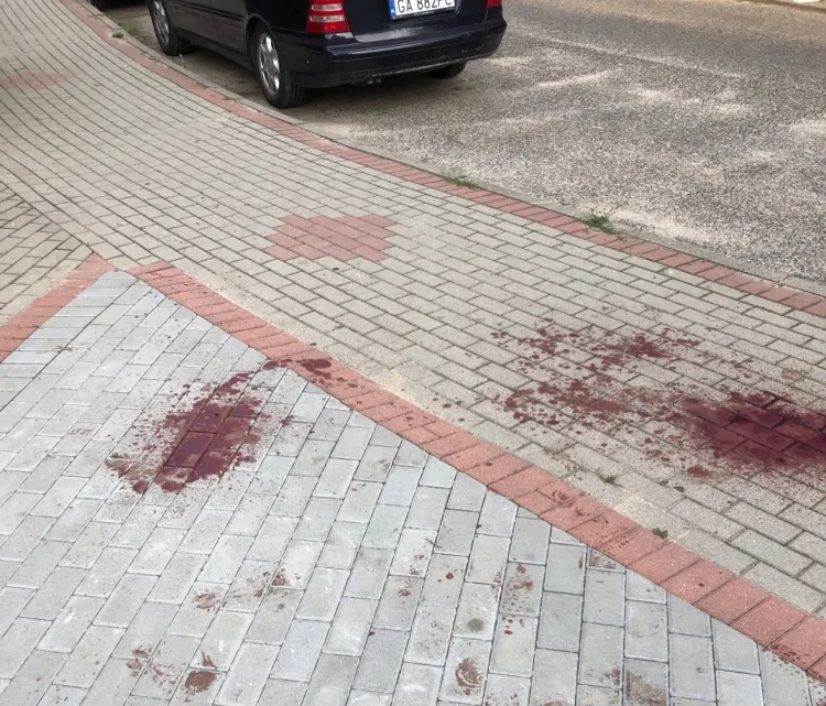Ranami ciętymi i sporymi plamami krwi na chodniku zakończyła się nocna libacja alkoholowa w Gdyni-Dąbrowie. Sprawcy szuka policja. 