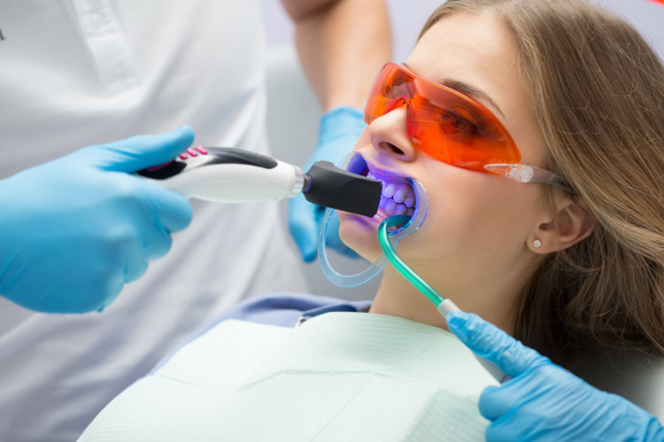 Wybielanie zębów w gabinetach stomatologicznych uważane jest za najbezpieczniejsze i najbardziej skuteczne.