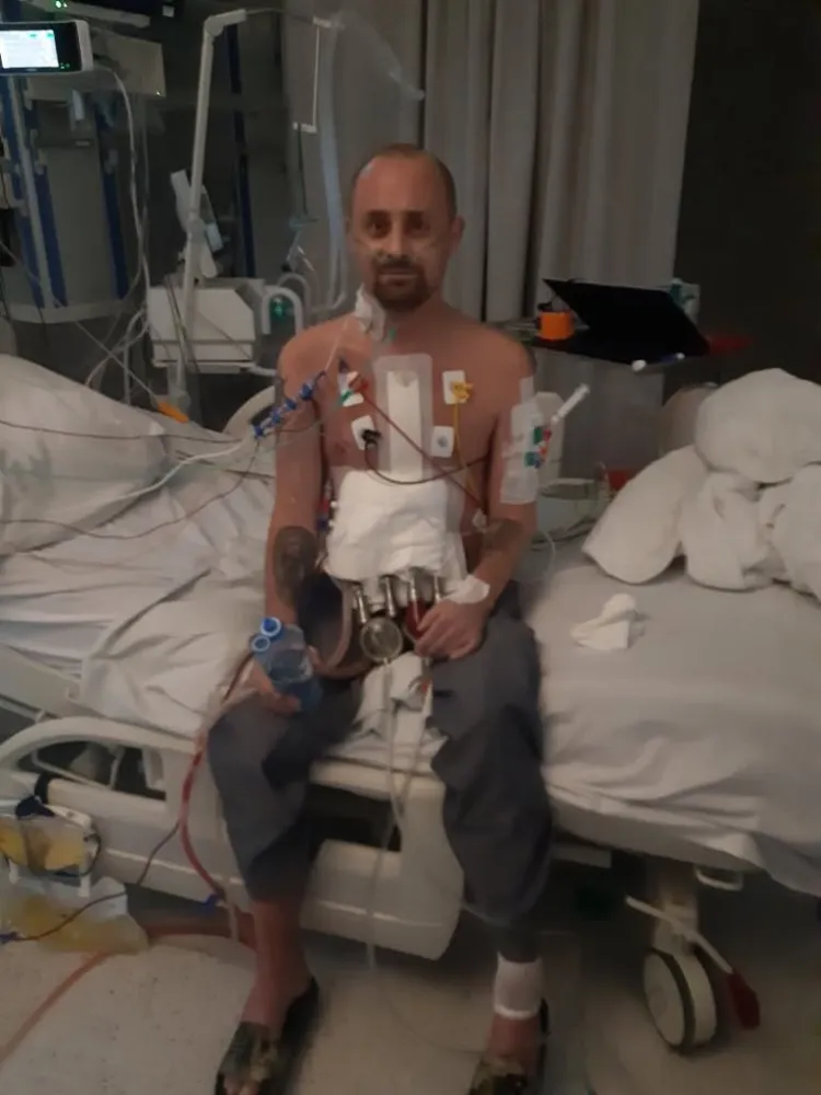 Pacjent otrzymał tzw. mechaniczne wspomaganie krążenia. Zaczął funkcjonować ze specjalistycznymi zewnętrznymi pompami serca.