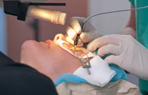 W trójmieście jest kilka klinik, które oferują zabieg laserowej korekcji wzroku.